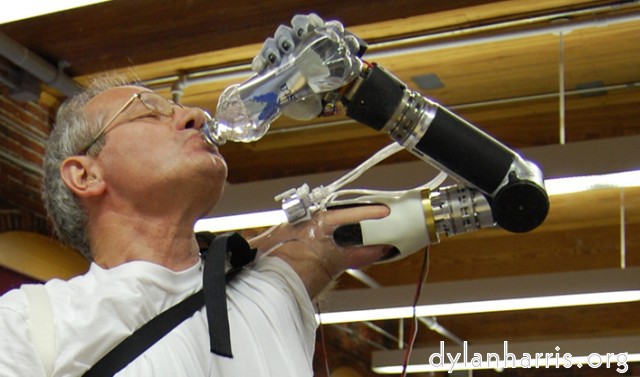 image: Prosthetic arm approved (arstechnica)