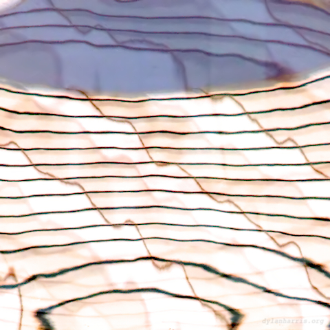 image: unlabelled image