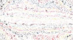 texture strokes :: brushbkmodtex4