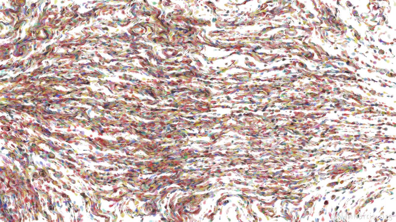 spletteryliquid1