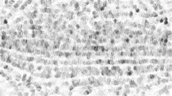 fizzy :: fizzyscratchy