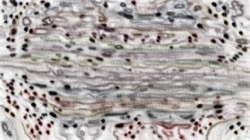 whispy attractors :: whispy6a