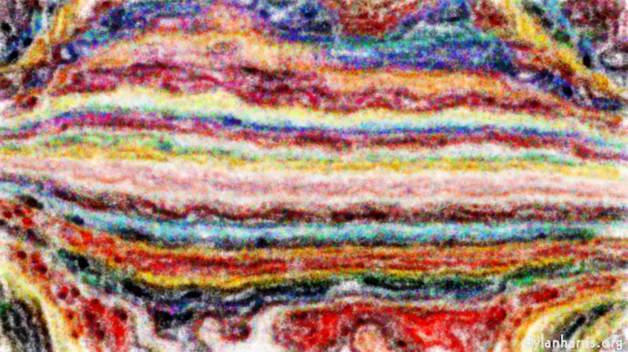 softshiftsprackleb