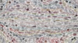nagal series 08 :: hollowbristles2